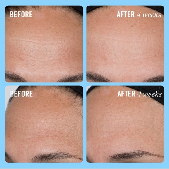 🍓5 for $20 - Ultra Repair Firming Collagen Cream Moisturizer - First Aid Beauty - Picture 5 of 11